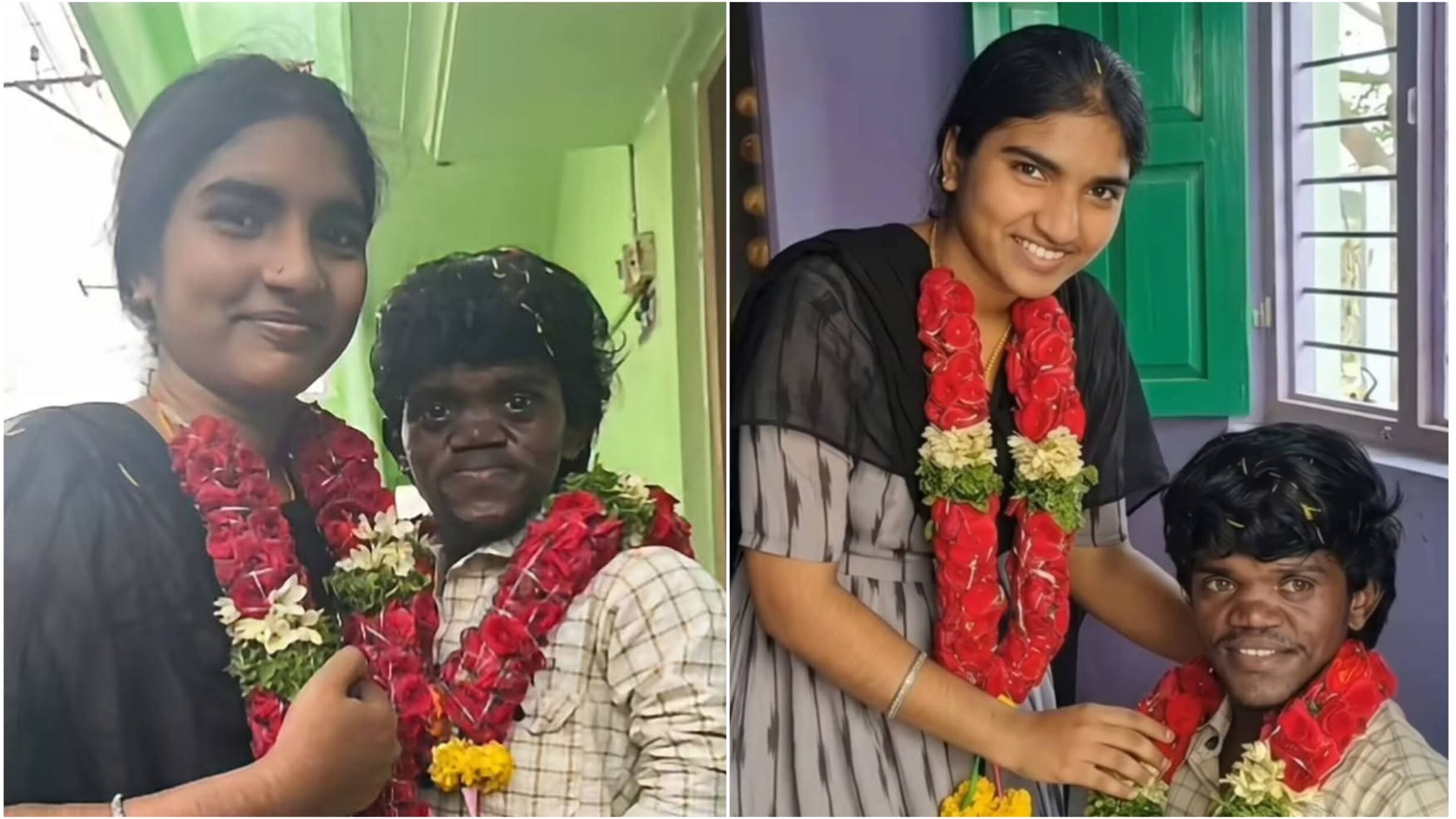 ಪ್ರೀತಿಗೆ ಅಂಗವೈಕಲ್ಯ ಅಡ್ಡಬಾರದು :- 3 ಅಡಿ ಎತ್ತರದ ಯುವಕನ  ಕೈ ಹಿಡಿದ 5 ಅಡಿ ಯುವತಿ..!